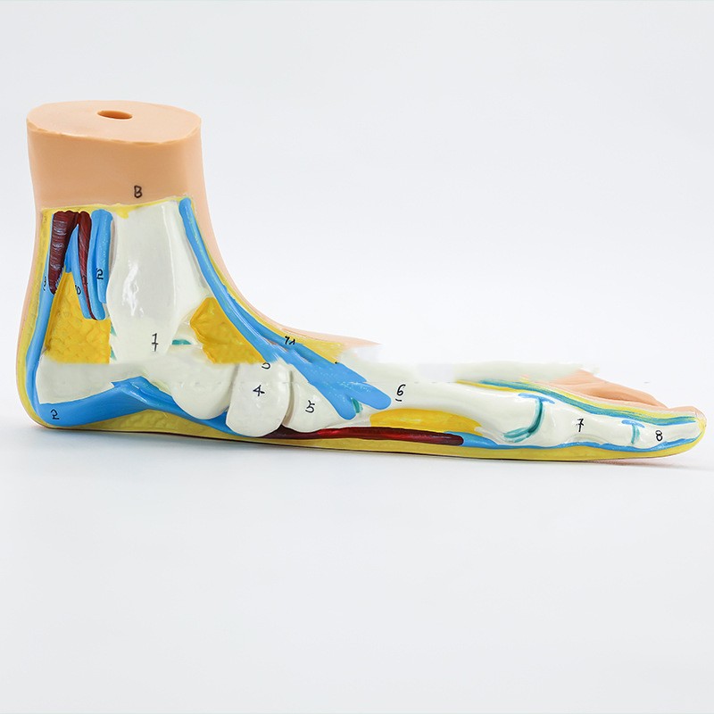 Plastic Model Of Human Bow Foot