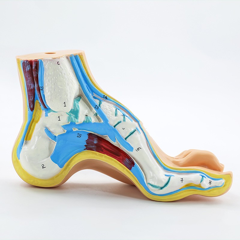 Plastic Model Of Human Bow Foot