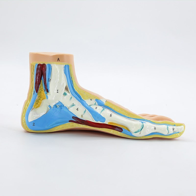 Plastic Model Of Human Bow Foot