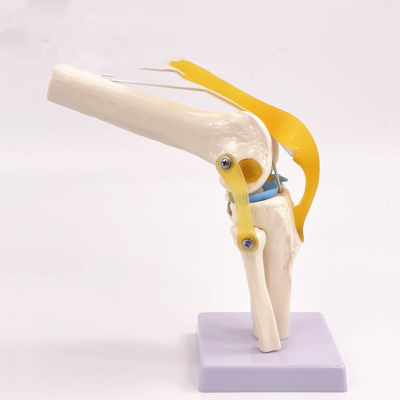 Artificial Human Knee Joint Model