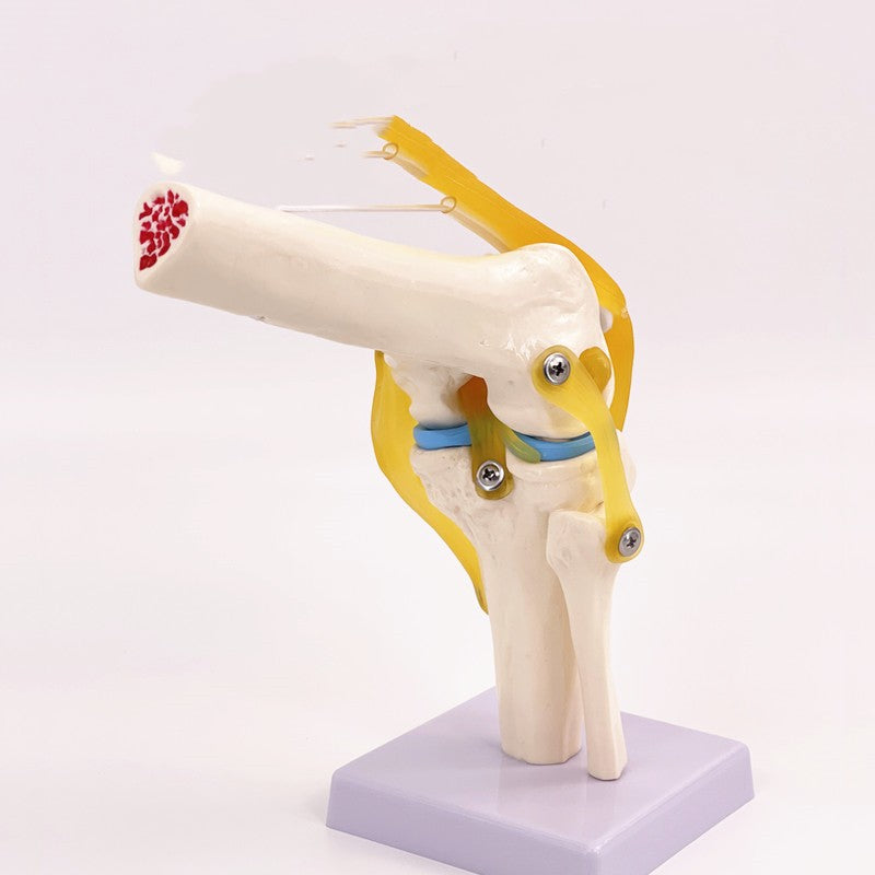 Artificial Human Knee Joint Model