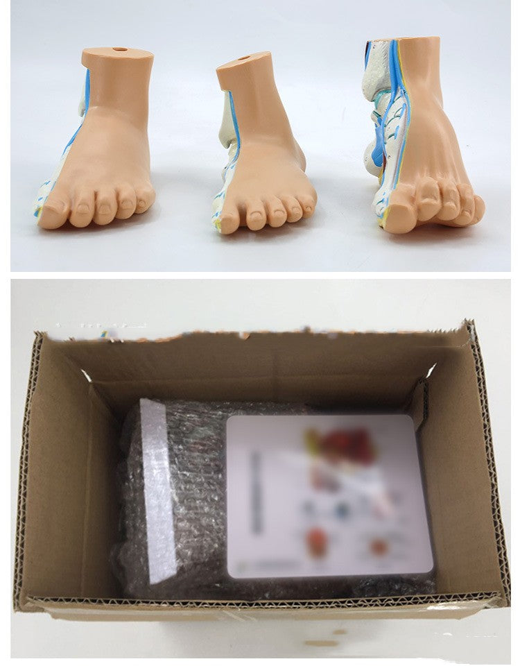 Plastic Model Of Human Bow Foot