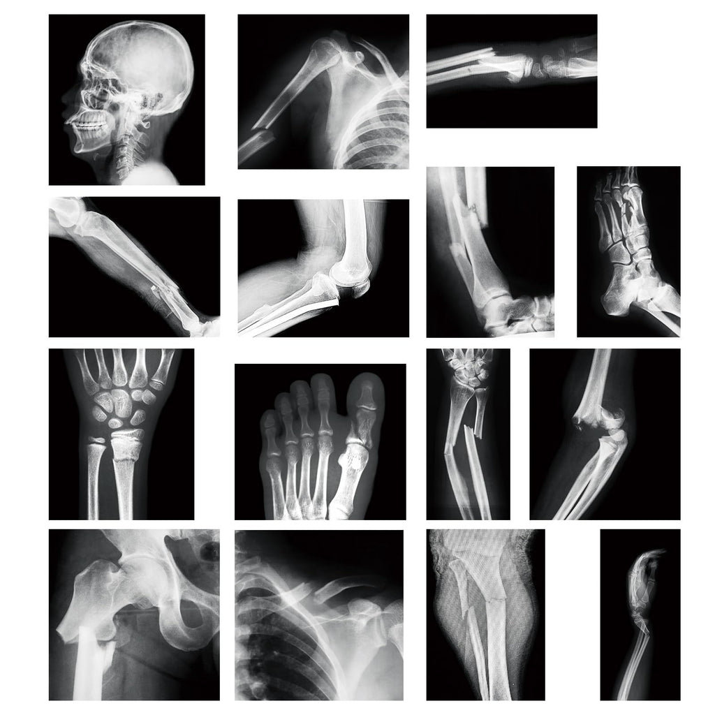 Sayglossy 15 Pcs Human X-Rays Black and White Skeleton Anatomy Set