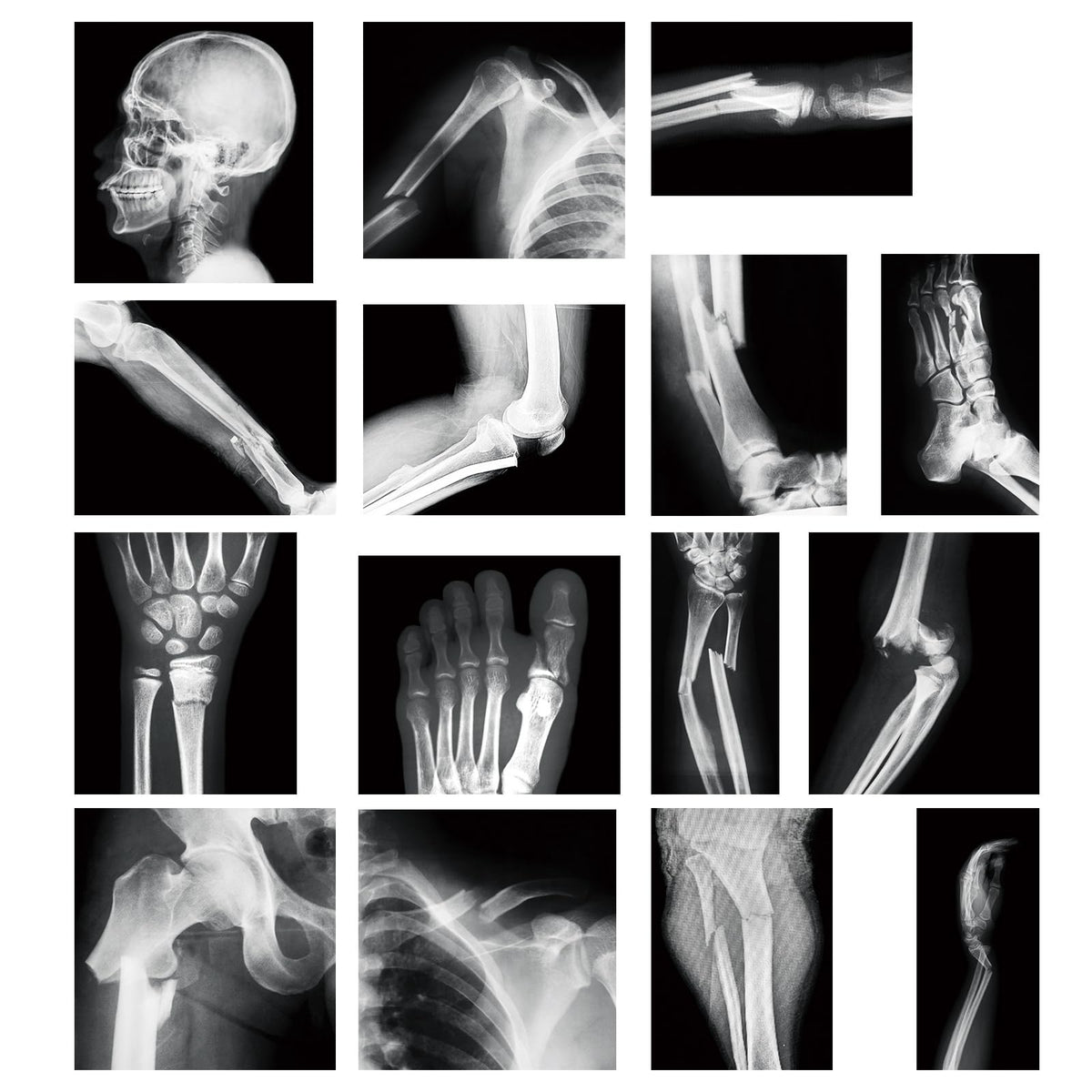 Sayglossy 15 Pcs Human X-Rays Black and White Skeleton Anatomy Set
