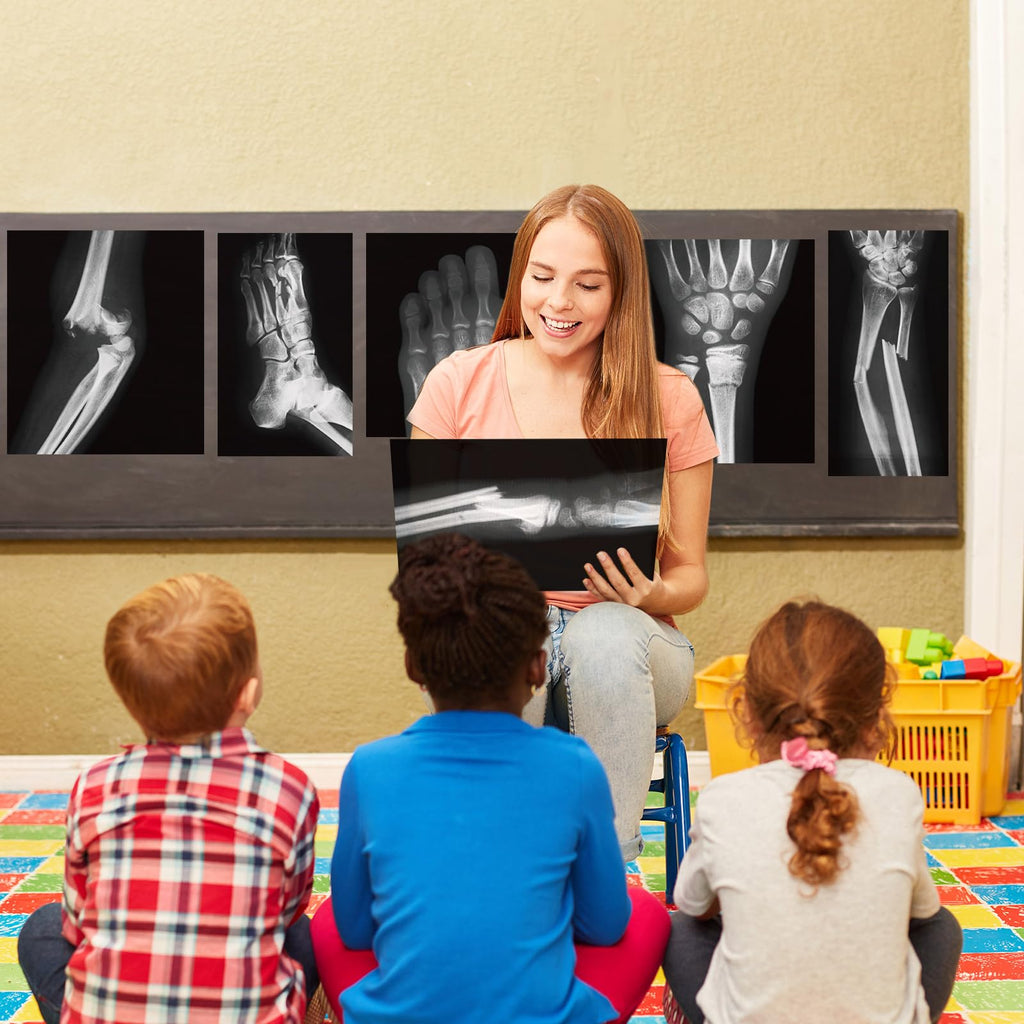 Sayglossy 15 Pcs Human X-Rays Black and White Skeleton Anatomy Set