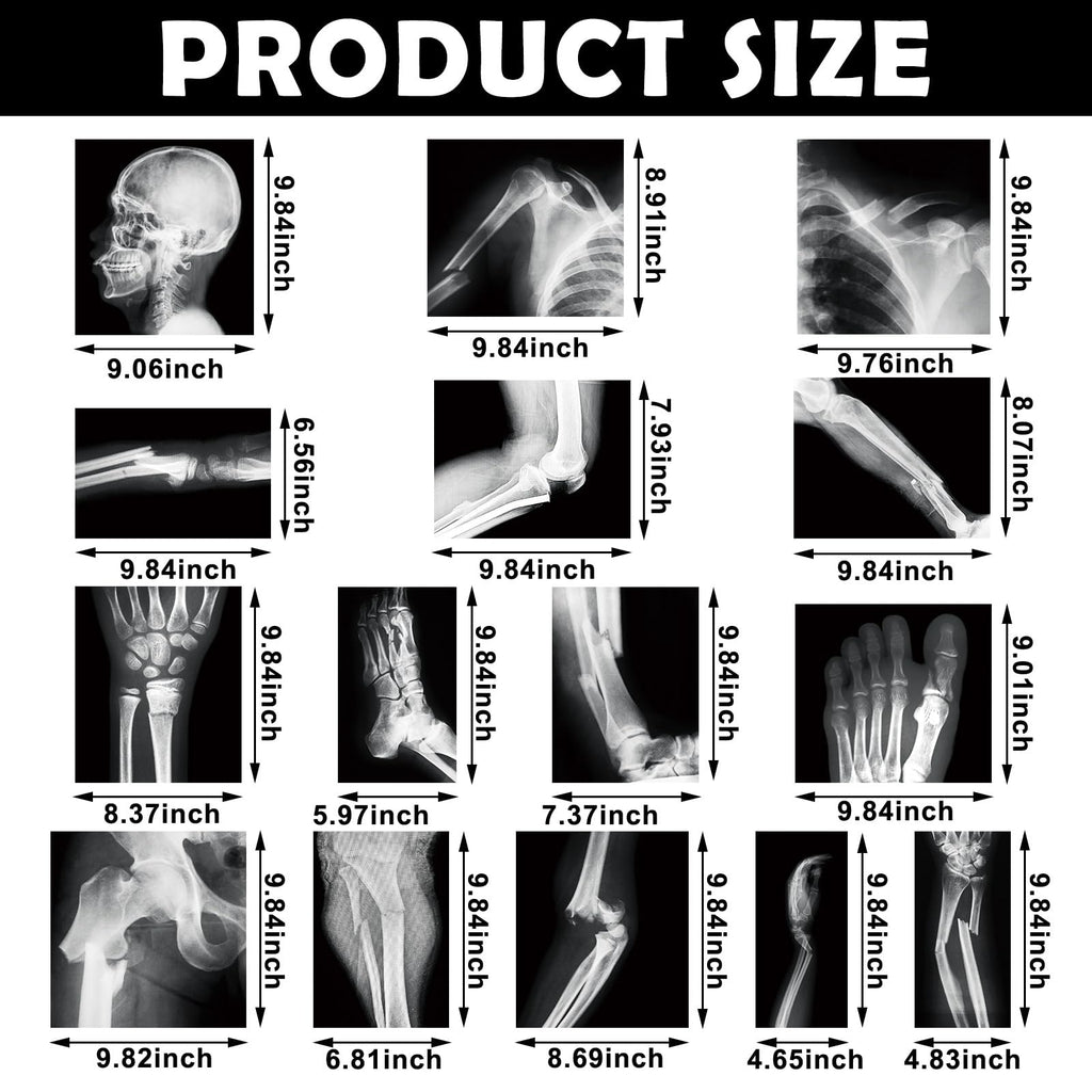 Sayglossy 15 Pcs Human X-Rays Black and White Skeleton Anatomy Set