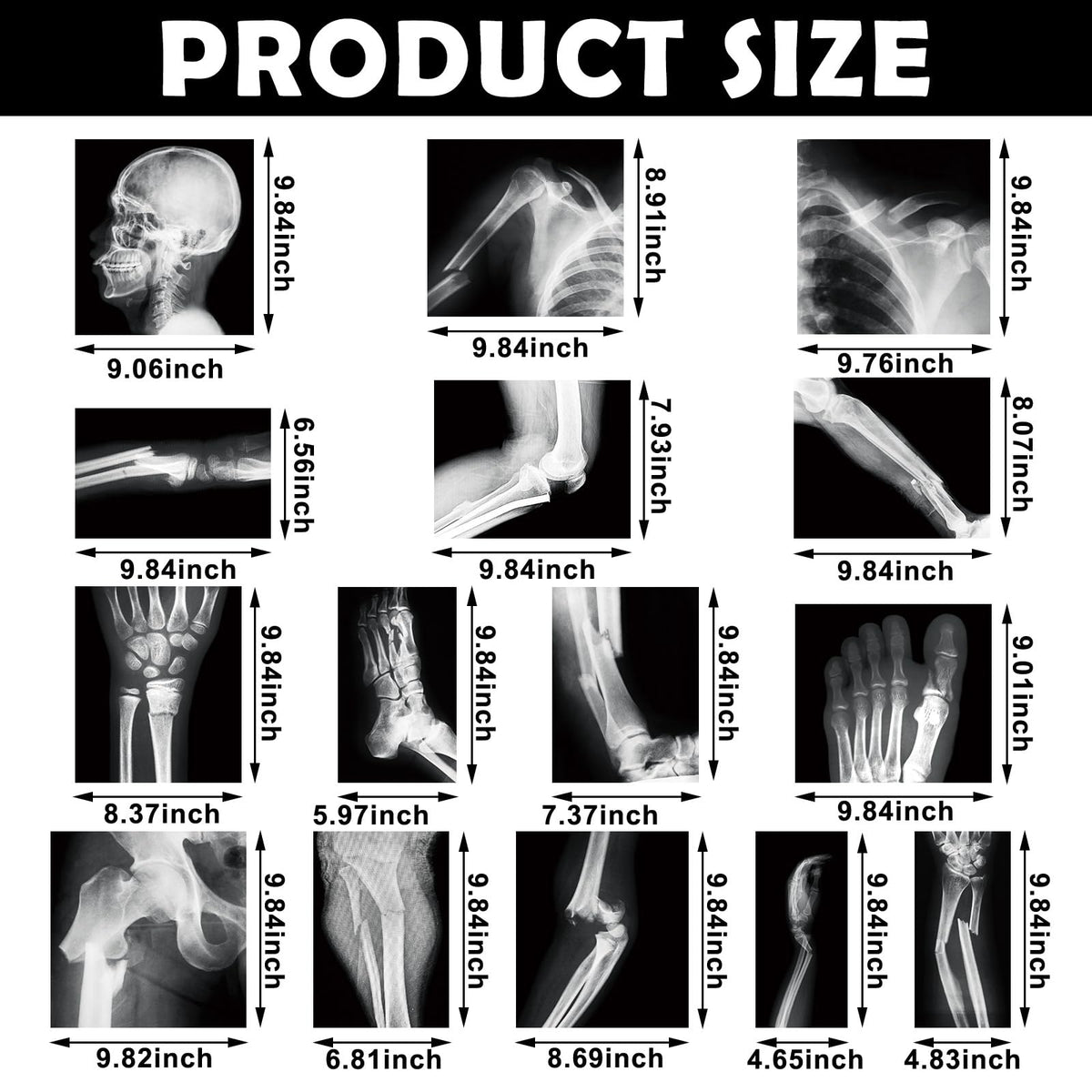 Sayglossy 15 Pcs Human X-Rays Black and White Skeleton Anatomy Set