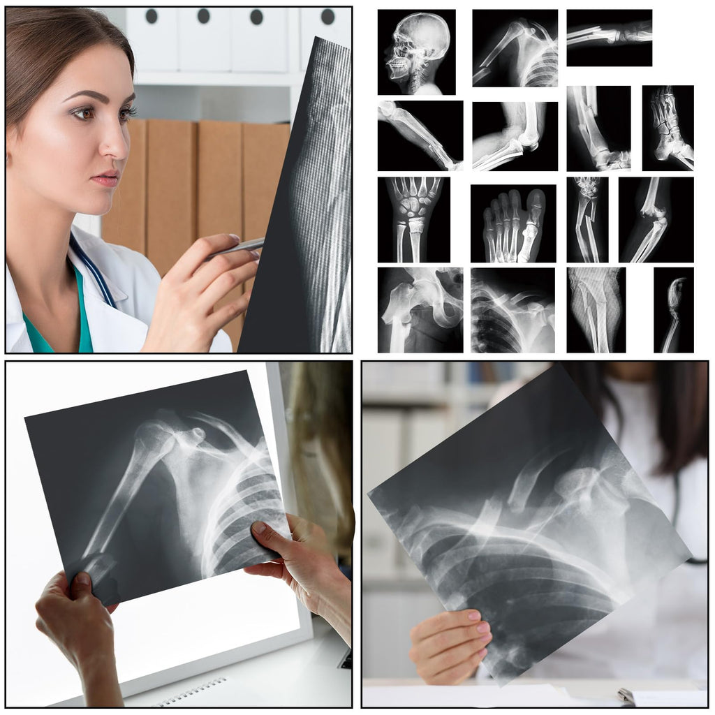 Sayglossy 15 Pcs Human X-Rays Black and White Skeleton Anatomy Set
