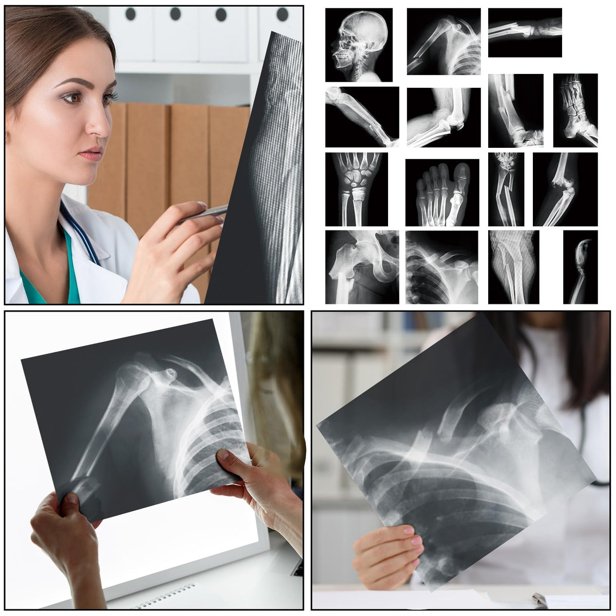 Sayglossy 15 Pcs Human X-Rays Black and White Skeleton Anatomy Set