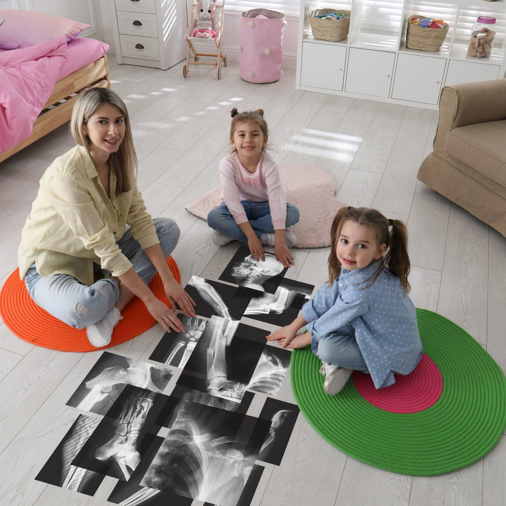 Sayglossy 15 Pcs Human X-Rays Black and White Skeleton Anatomy Set