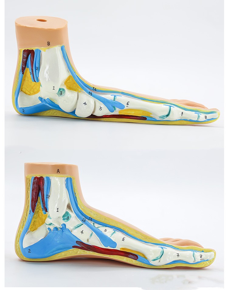 Plastic Model Of Human Bow Foot