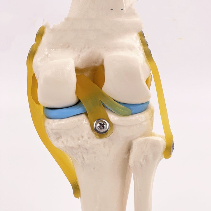 Artificial Human Knee Joint Model