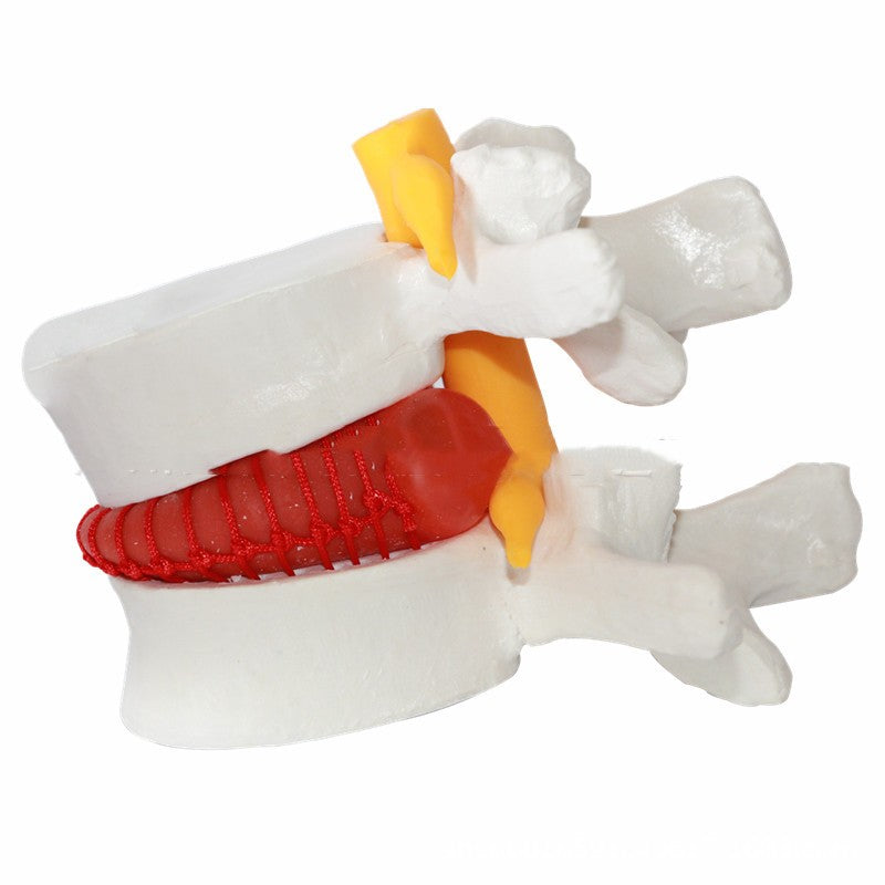Lumbar Model Teaching Medical Human Body